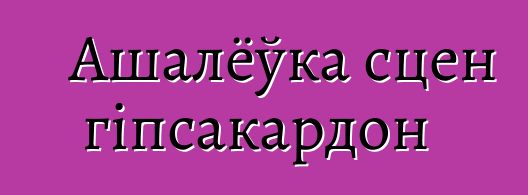 Ашалёўка сцен гіпсакардон