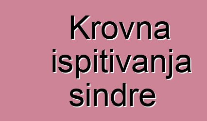 Krovna ispitivanja šindre